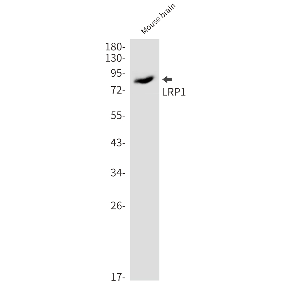 Rabbit Monoclonal Antibody to LRP1