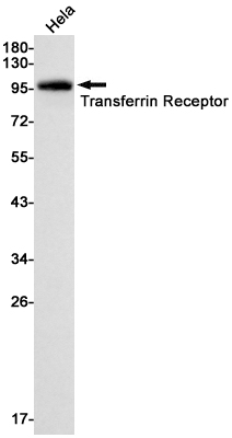 Rabbit Monoclonal Antibody to Transferrin Receptor 1