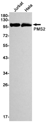 Rabbit Monoclonal Antibody to PMS2
