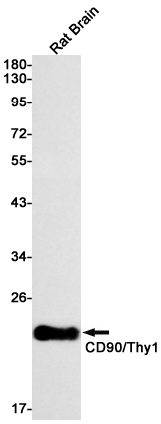 Rabbit Monoclonal Antibody to CD90