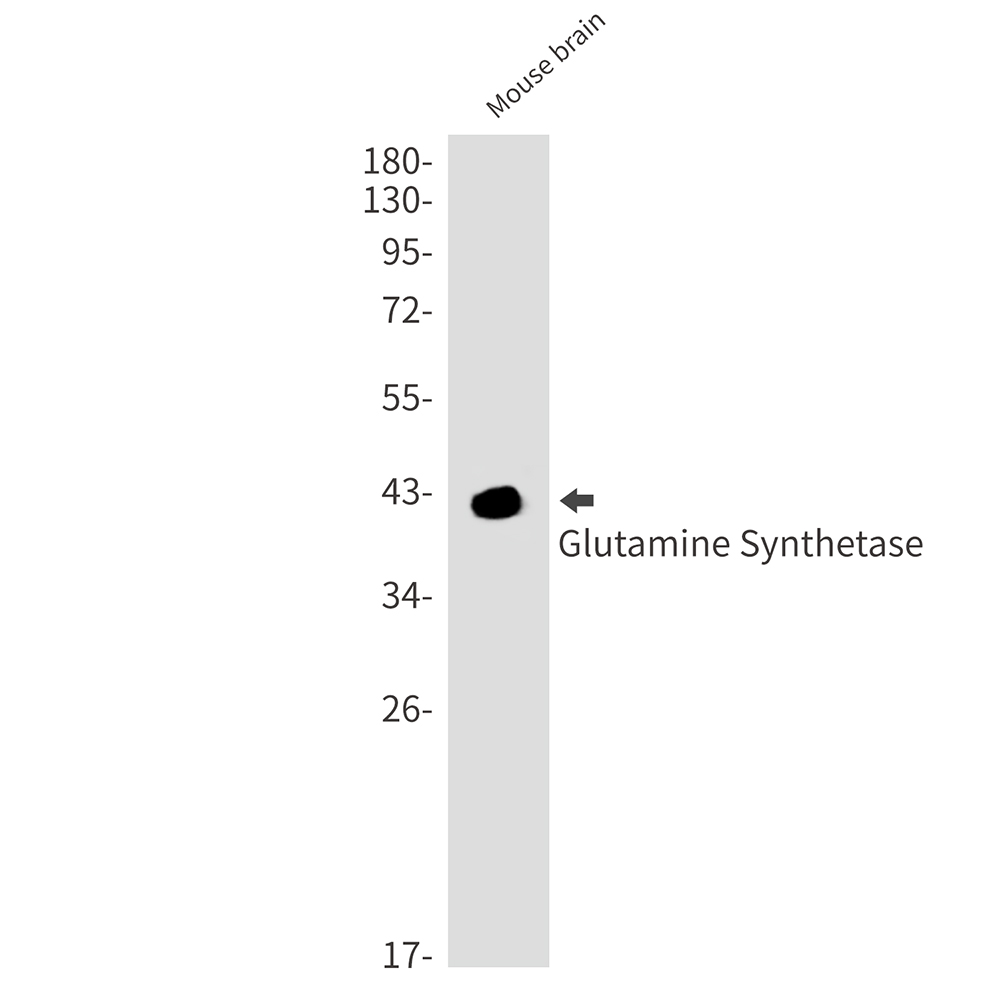 Rabbit Monoclonal Antibody to Glutamine Synthetase