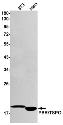 Rabbit Monoclonal Antibody to PBR