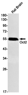 Rabbit Monoclonal Antibody to 45201