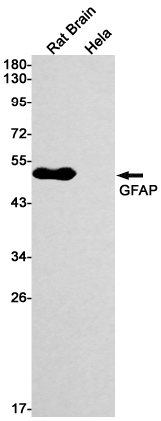 Rabbit Monoclonal Antibody to GFAP