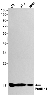 Rabbit Monoclonal Antibody to Profilin 1