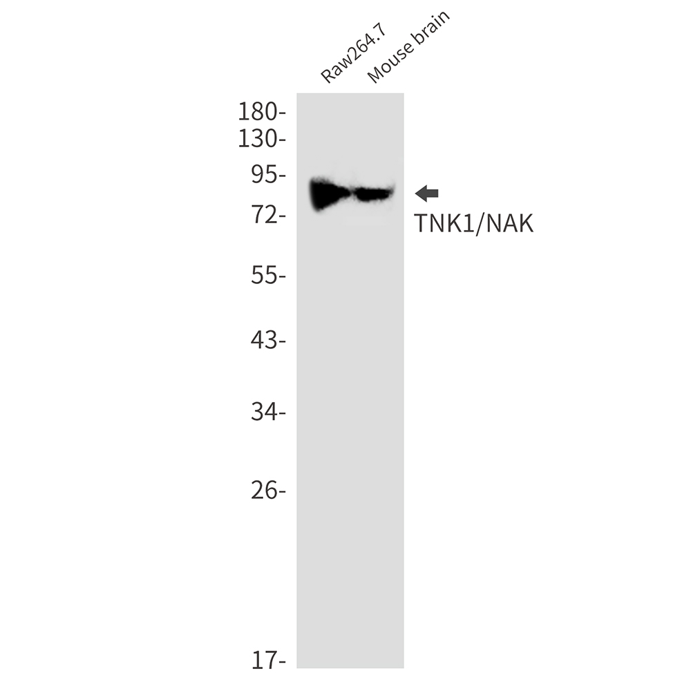 Rabbit Monoclonal Antibody to TBK1