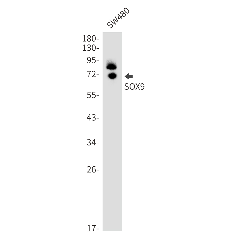 Rabbit Monoclonal Antibody to SOX9