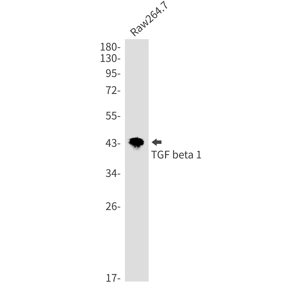 Rabbit Monoclonal Antibody to TGF beta 1