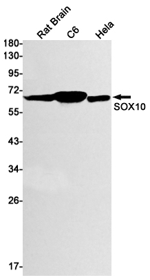 Rabbit Monoclonal Antibody to SOX10