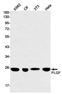 Rabbit Monoclonal Antibody to PLGF