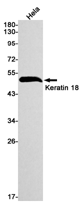 Rabbit Monoclonal Antibody to Cytokeratin 18