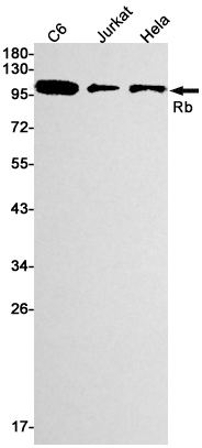 Rabbit Monoclonal Antibody to Rb