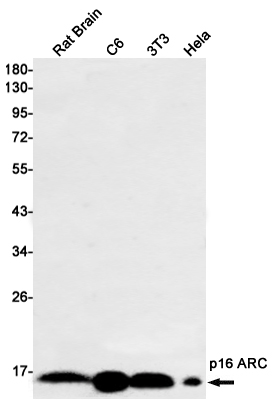 Rabbit Monoclonal Antibody to p16 ARC