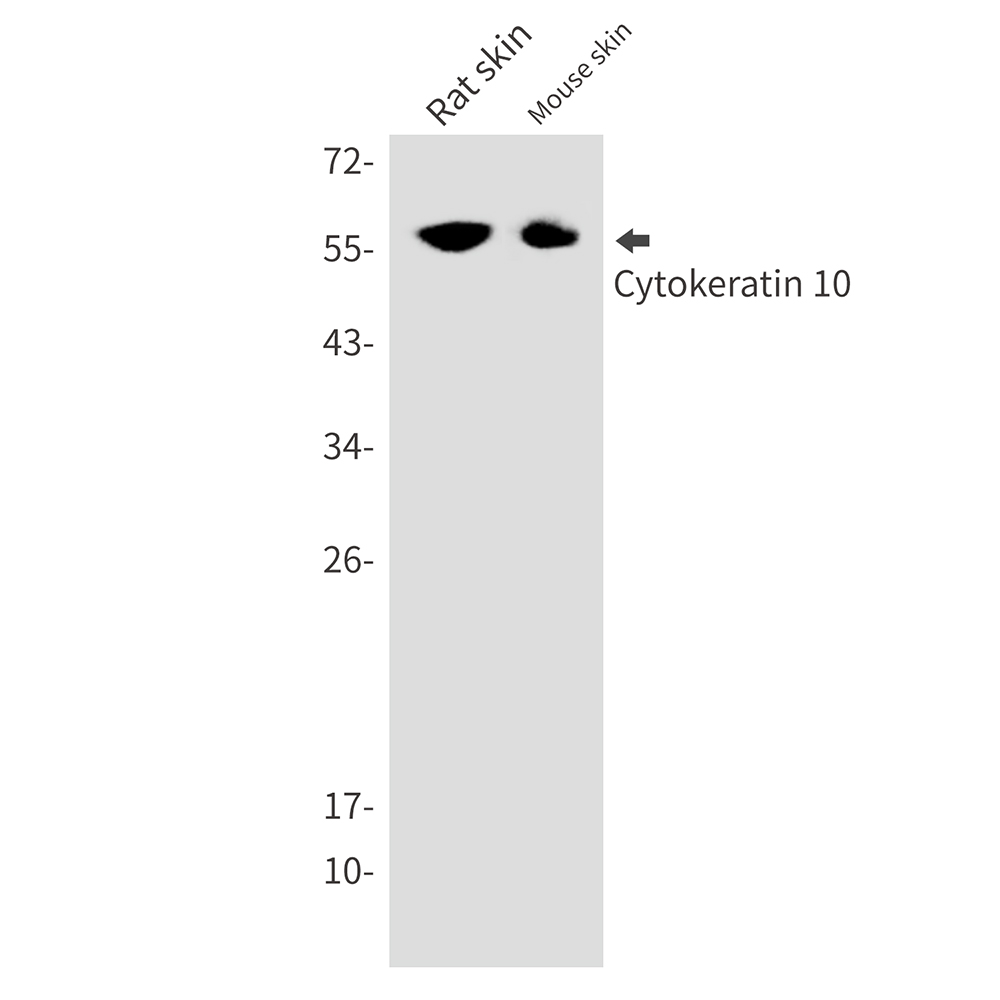 Rabbit Monoclonal Antibody to Cytokeratin 10