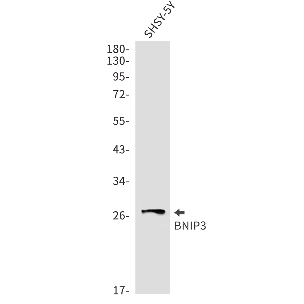 Rabbit Monoclonal Antibody to BNIP3