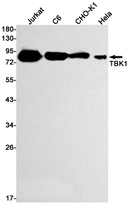 Rabbit Monoclonal Antibody to TBK1