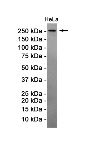 Rabbit Monoclonal Antibody to ATM