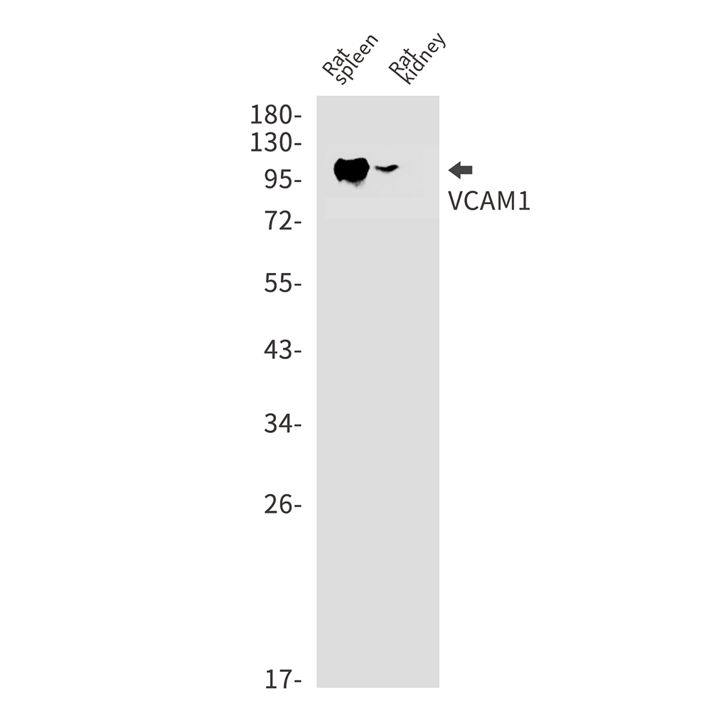 Rabbit Monoclonal Antibody to VCAM1