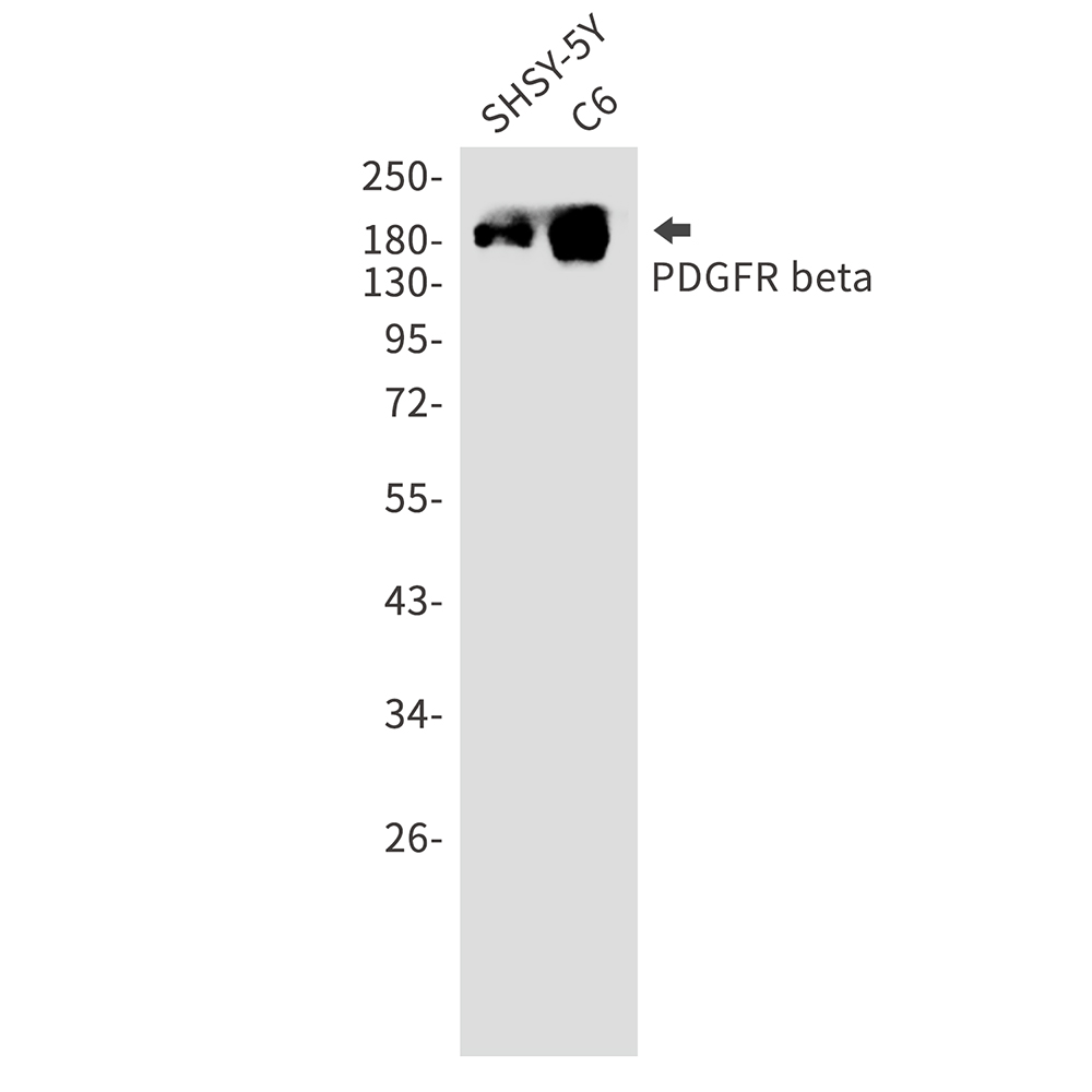 Rabbit Monoclonal Antibody to PDGFR beta