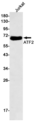 Rabbit Monoclonal Antibody to ATF2