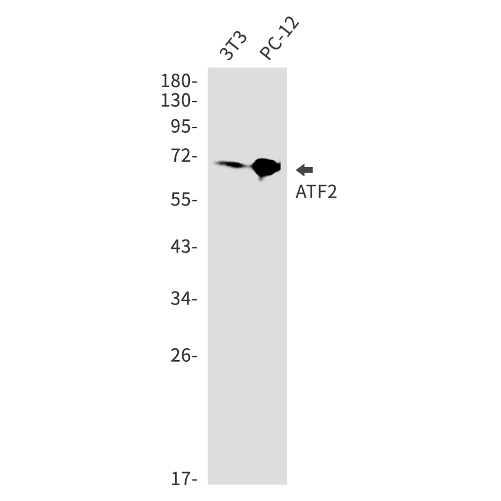 Rabbit Monoclonal Antibody to ATF2