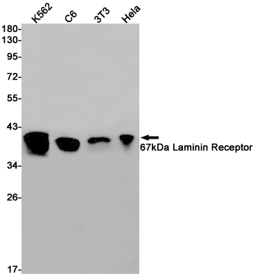 Rabbit Monoclonal Antibody to 67kDa Laminin Receptor