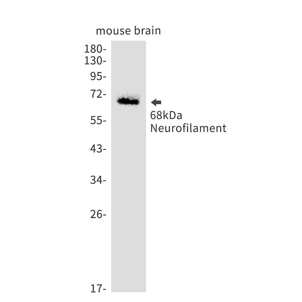 Rabbit Monoclonal Antibody to Neurofilament light polypeptide