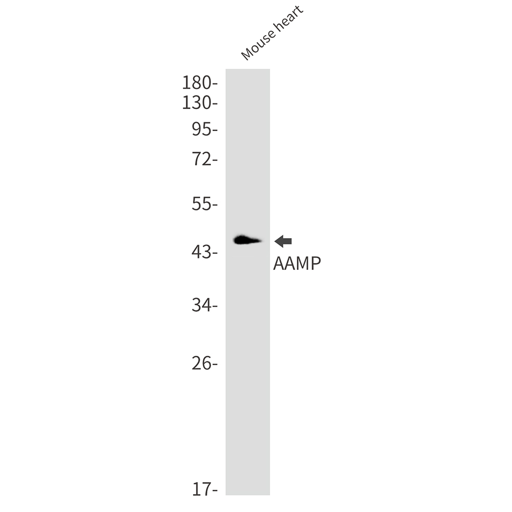Rabbit Monoclonal Antibody to AAMP