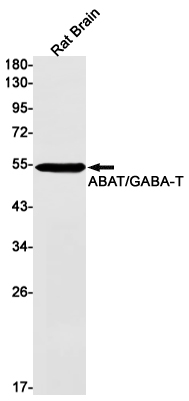 Rabbit Monoclonal Antibody to ABAT