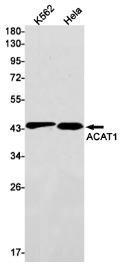 Rabbit Monoclonal Antibody to ACAT1