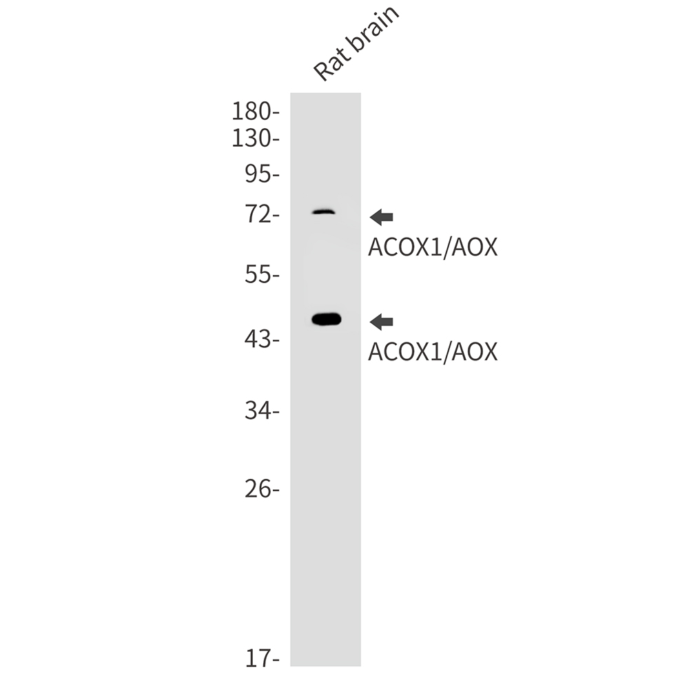 Rabbit Monoclonal Antibody to ACOX1
