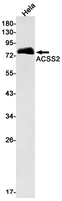 Rabbit Monoclonal Antibody to ACSS2