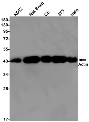 Rabbit Monoclonal Antibody to alpha Skeletal Muscle Actin