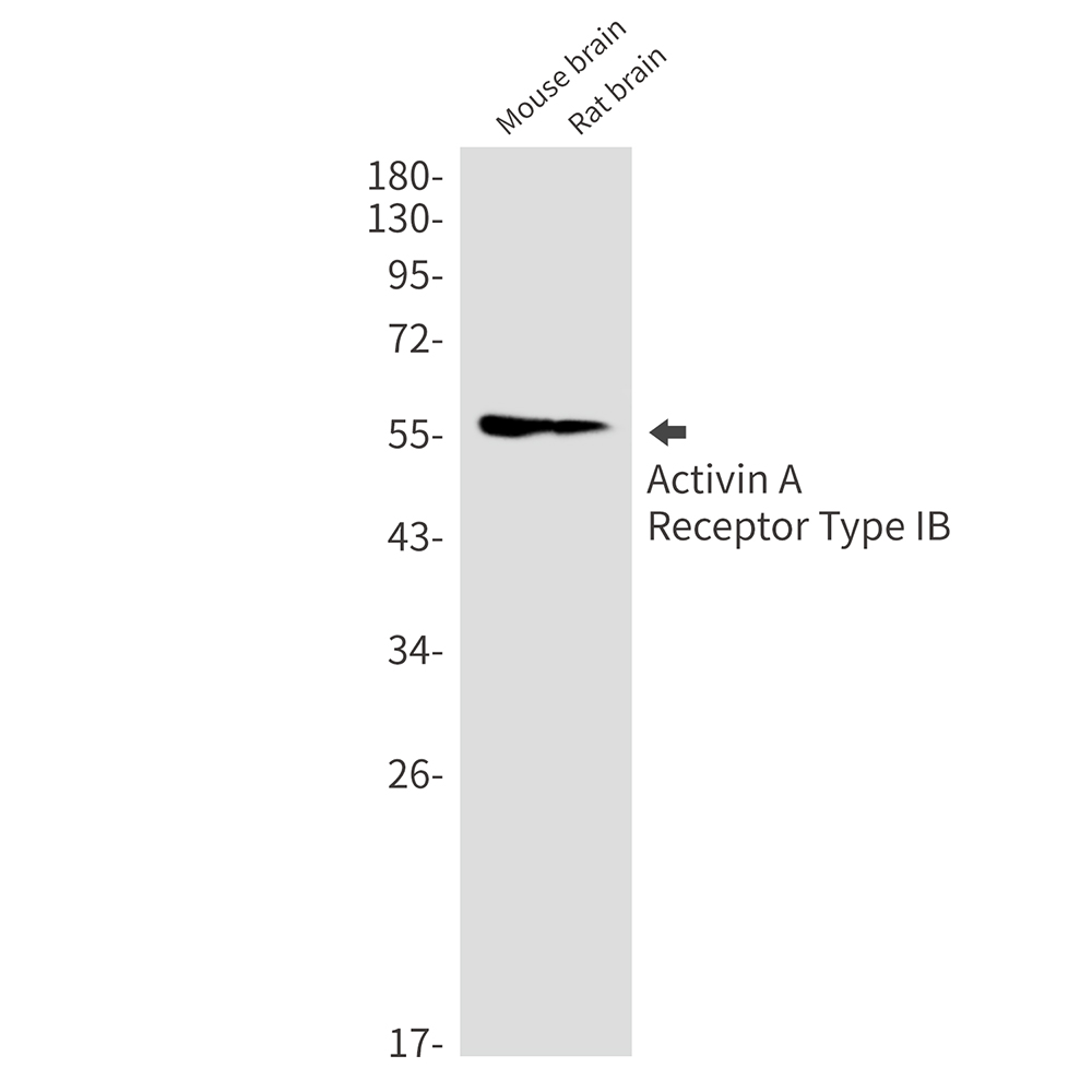 Rabbit Monoclonal Antibody to Activin A Receptor Type IB