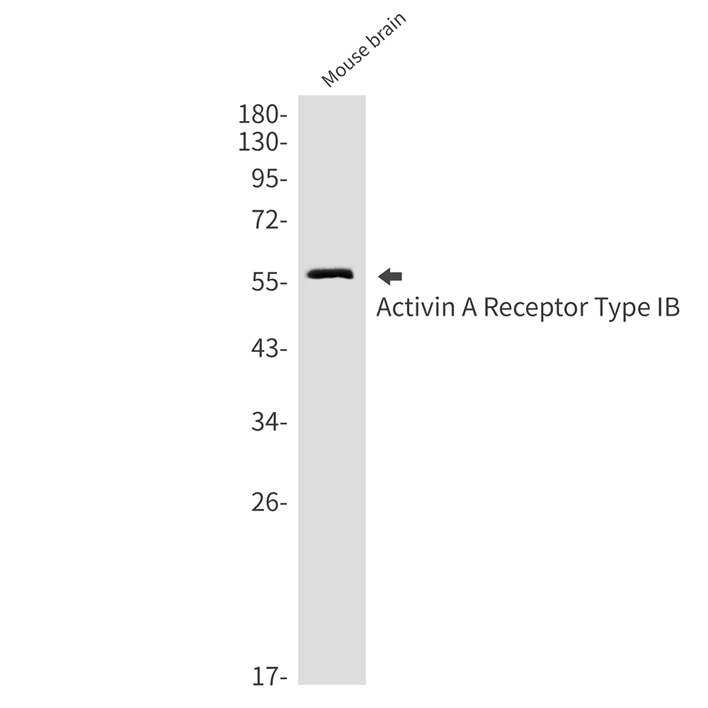 Rabbit Monoclonal Antibody to Activin A Receptor Type IB