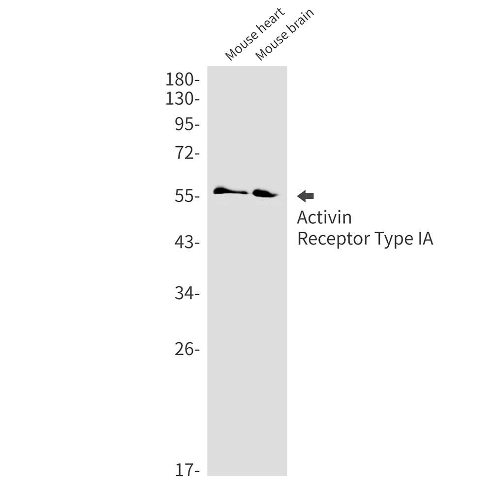 Rabbit Monoclonal Antibody to Activin Receptor Type IA