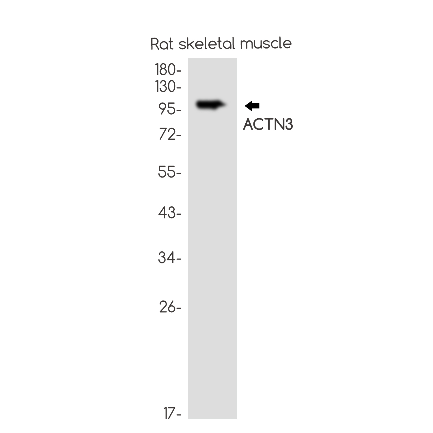 Rabbit Monoclonal Antibody to ACTN3