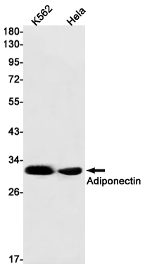 Rabbit Monoclonal Antibody to Adiponectin
