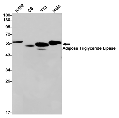 Rabbit Monoclonal Antibody to Adipose Triglyceride Lipase