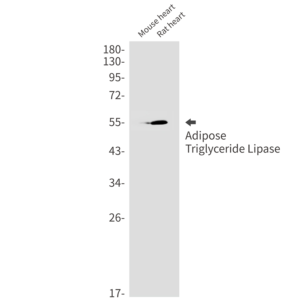 Rabbit Monoclonal Antibody to Adipose Triglyceride Lipase