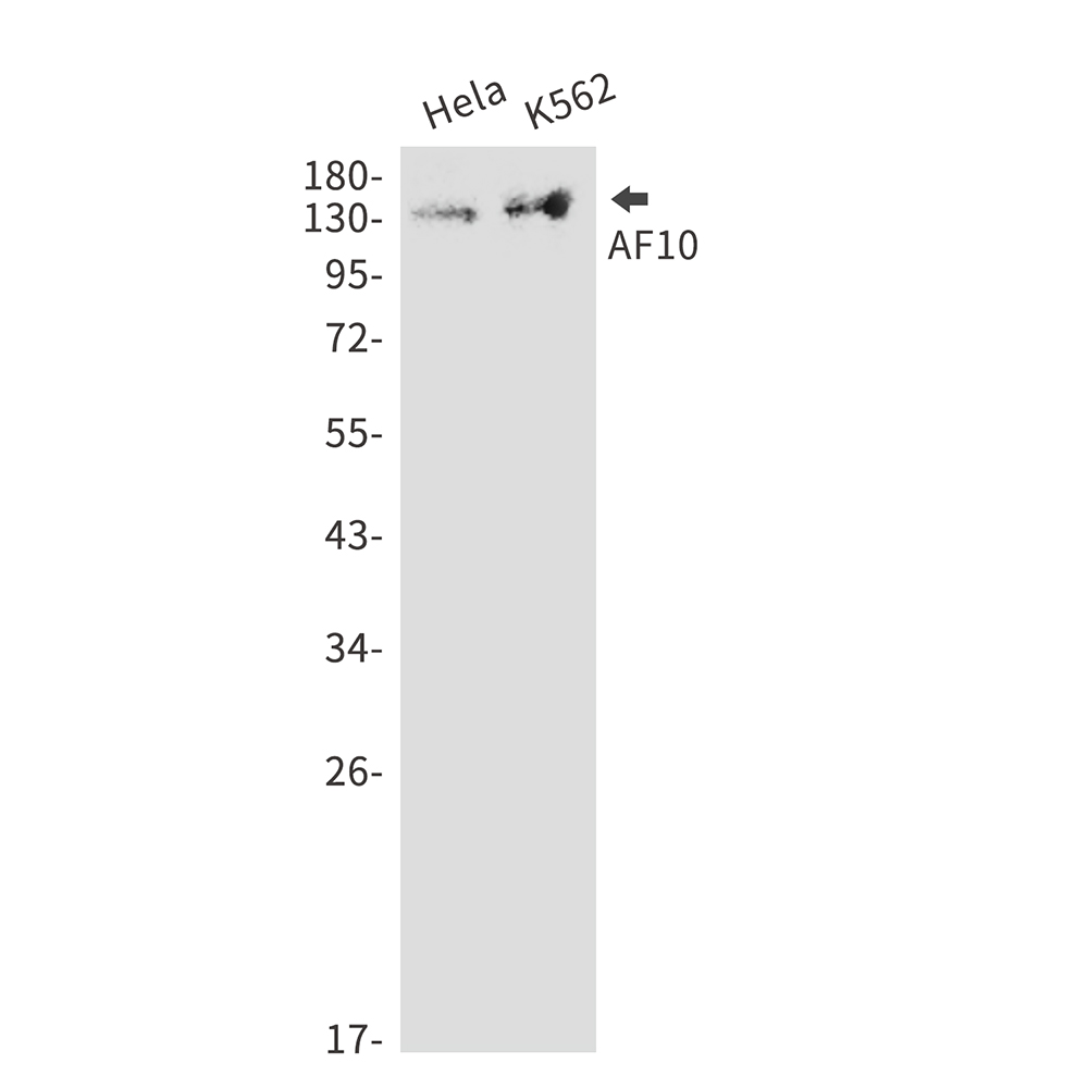 Rabbit Monoclonal Antibody to AF10