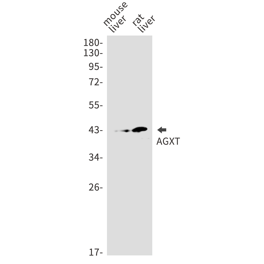 Rabbit Monoclonal Antibody to AGXT