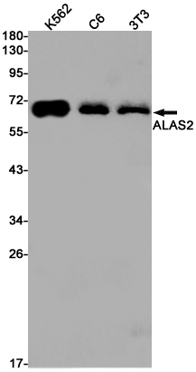 Rabbit Monoclonal Antibody to ALAS2