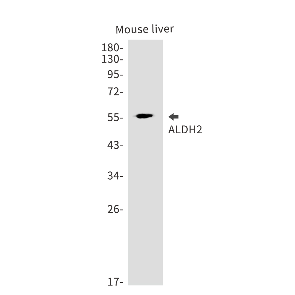 Rabbit Monoclonal Antibody to ALDH2