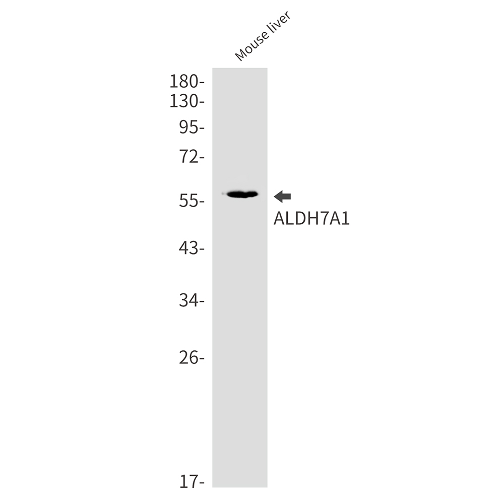 Rabbit Monoclonal Antibody to ALDH7A1