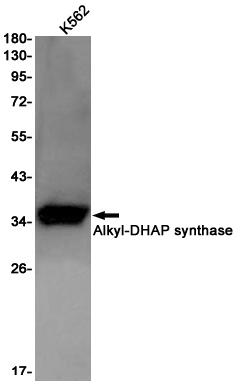 Rabbit Monoclonal Antibody to AGPS