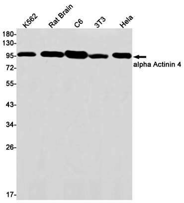 Rabbit Monoclonal Antibody to alpha Actinin 4