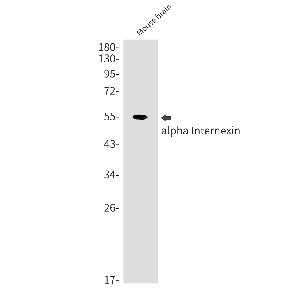 Rabbit Monoclonal Antibody to alpha Internexin