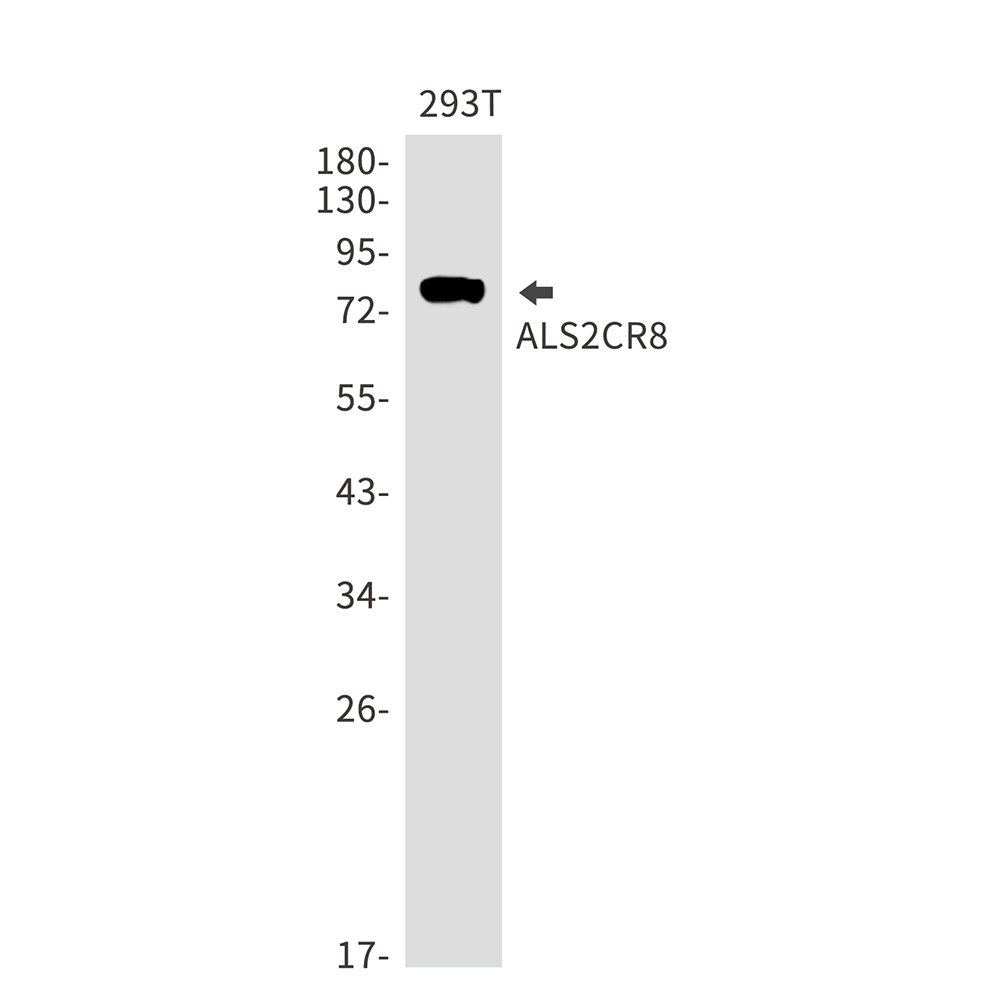 Rabbit Monoclonal Antibody to ALS2CR8