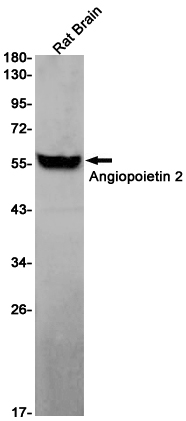 Rabbit Monoclonal Antibody to Angiopoietin 2
